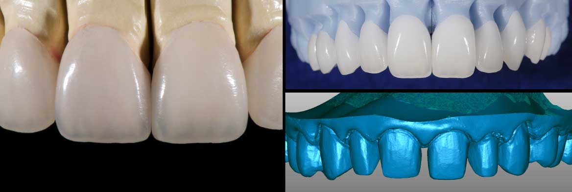 Teethheader.jpg